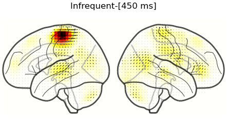 Infrequent-[450 ms]